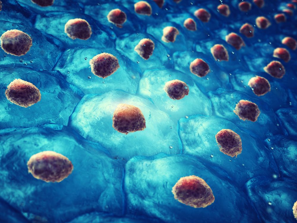 "Pacientul din Geneva", a şasea persoană vindecată de HIV după un transplant de măduvă osoasă. De ce este unic acest caz