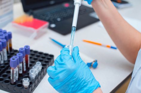 Consecinţele intoxicaţiei cu plumb asupra sănătăţii publice, drastic subestimate, avertizează un nou studiu