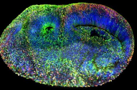 Creiere artificiale dezvăluie originile genetice ale tulburării de spectru autist