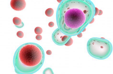O nouă perspectivă asupra eficacităţii limitate a tratamentelor actuale într-un tip rar de cancer