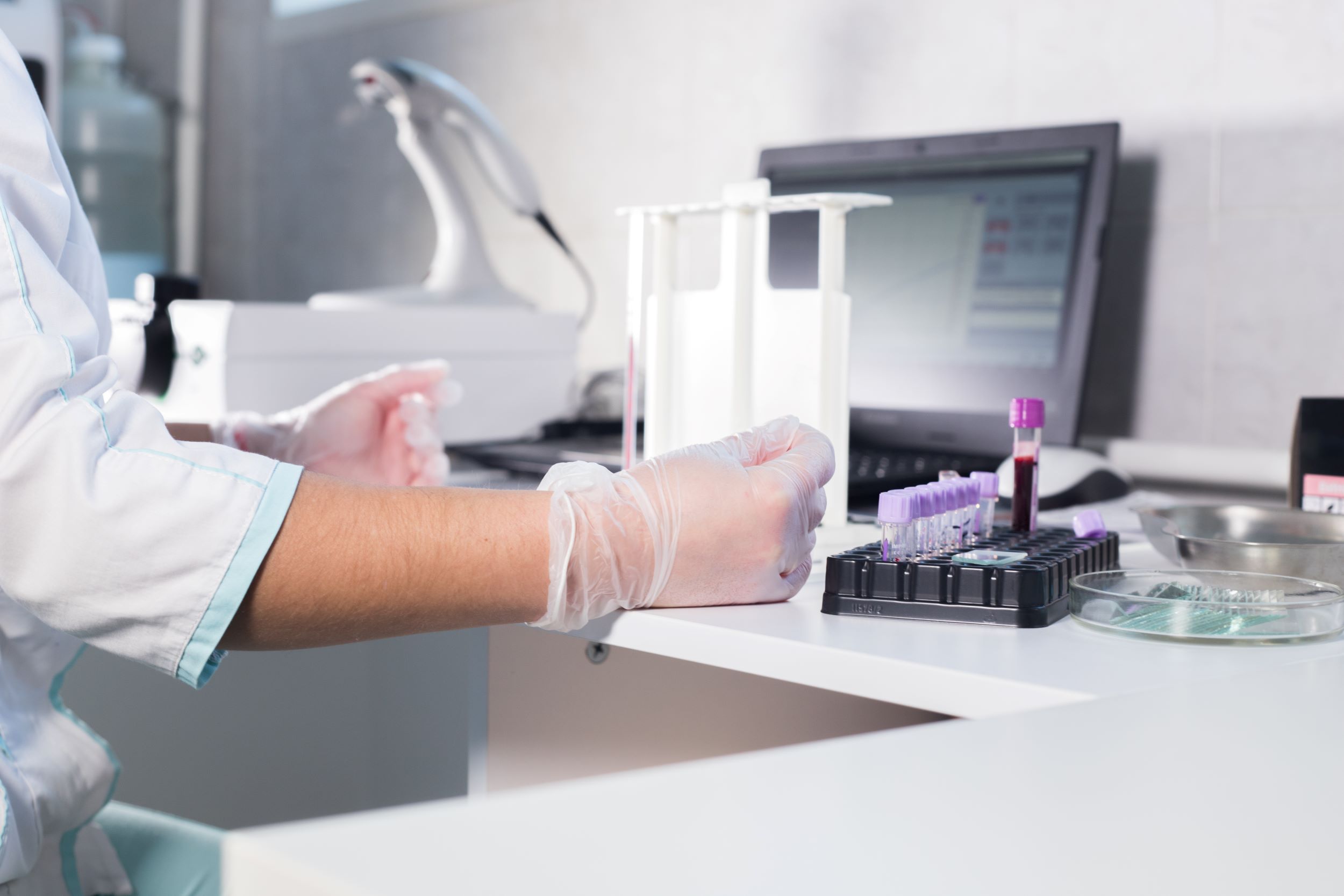 Un test de sânge ar putea depista boala Alzheimer înainte de apariţia simptomelor
