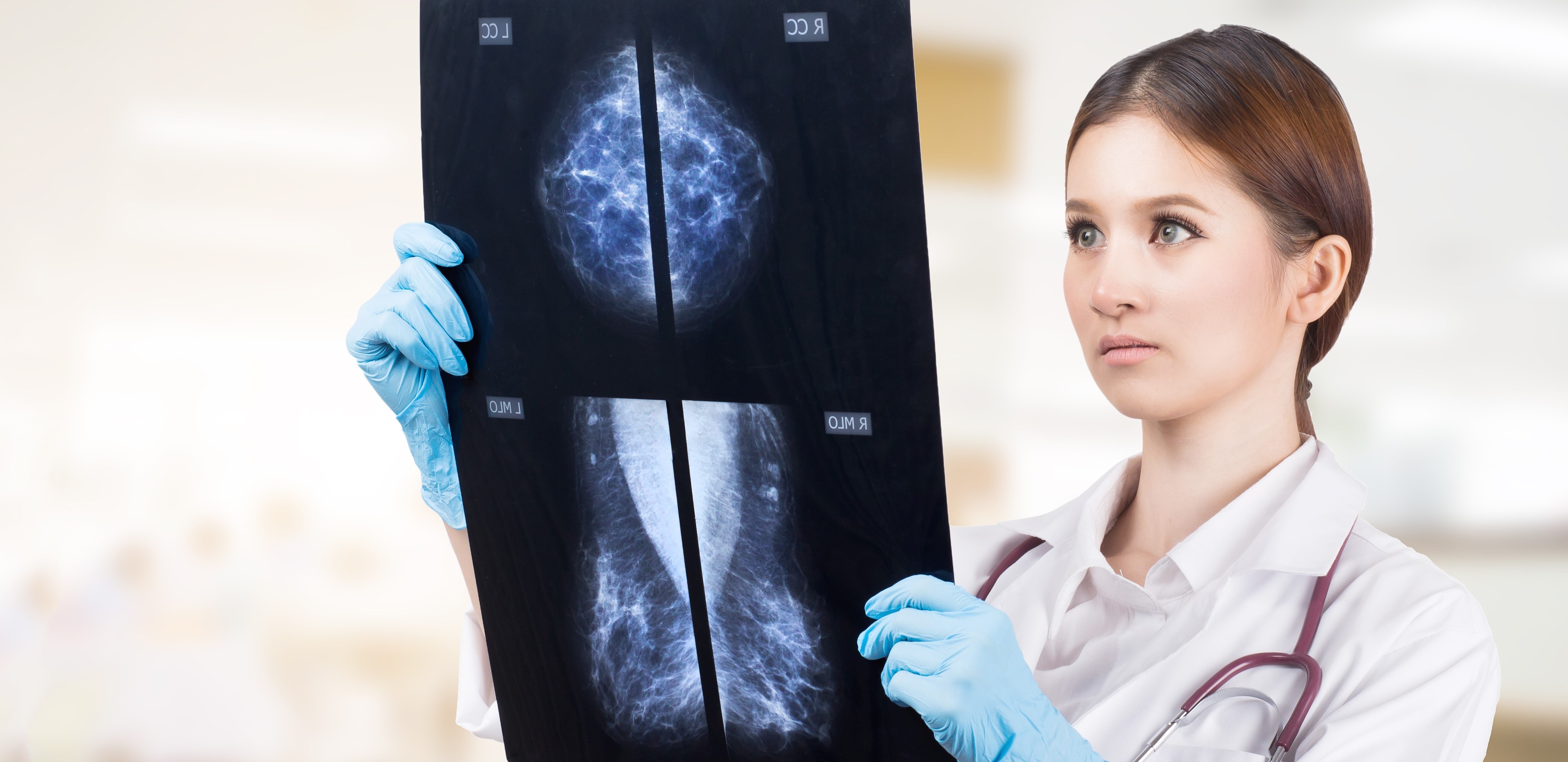 Studiile sugerează că unele paciente cu cancer de sân incipient ar putea evita o intervenţie chirurgicală