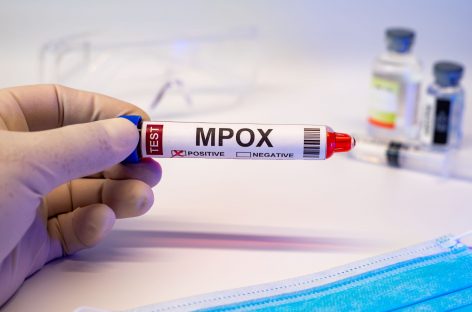 Cum se pregăteşte România pentru a face faţă răspândirii noii tulpini a mpox